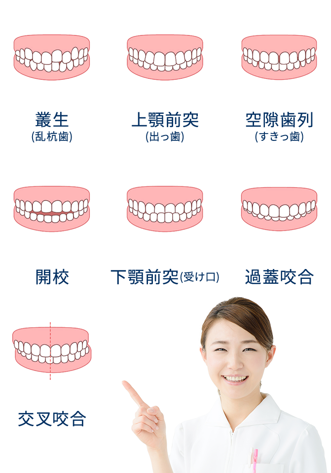 叢生・出っ歯・受け口など