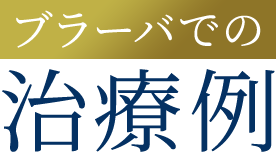 裏側矯正ブラーバでの治療例