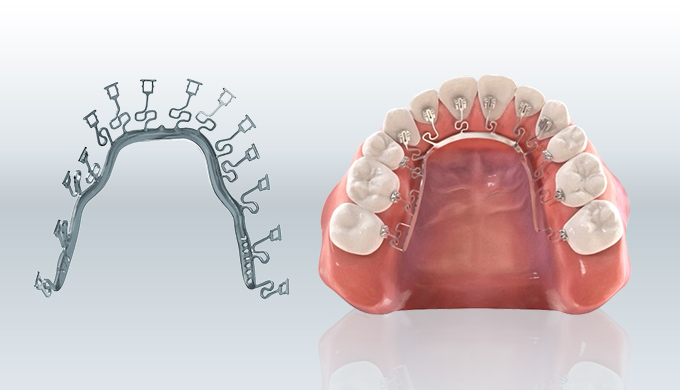 独自技術で歯への負担が少ない