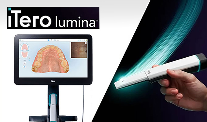 iTero・セファロレントゲンによる精密な診査・診断