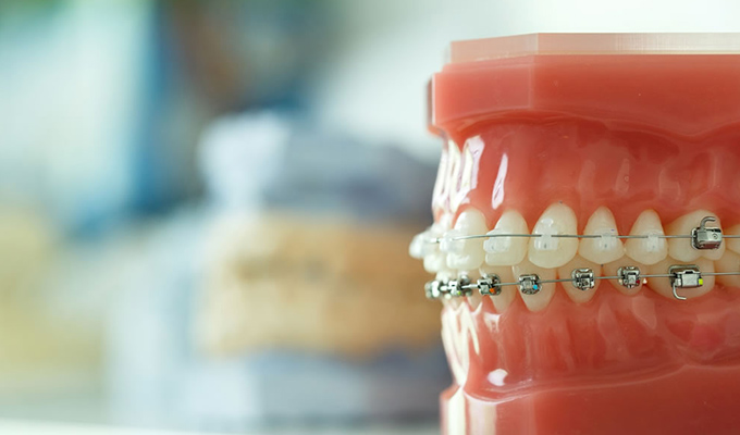 矯正治療の経験豊富な歯科医師が担当