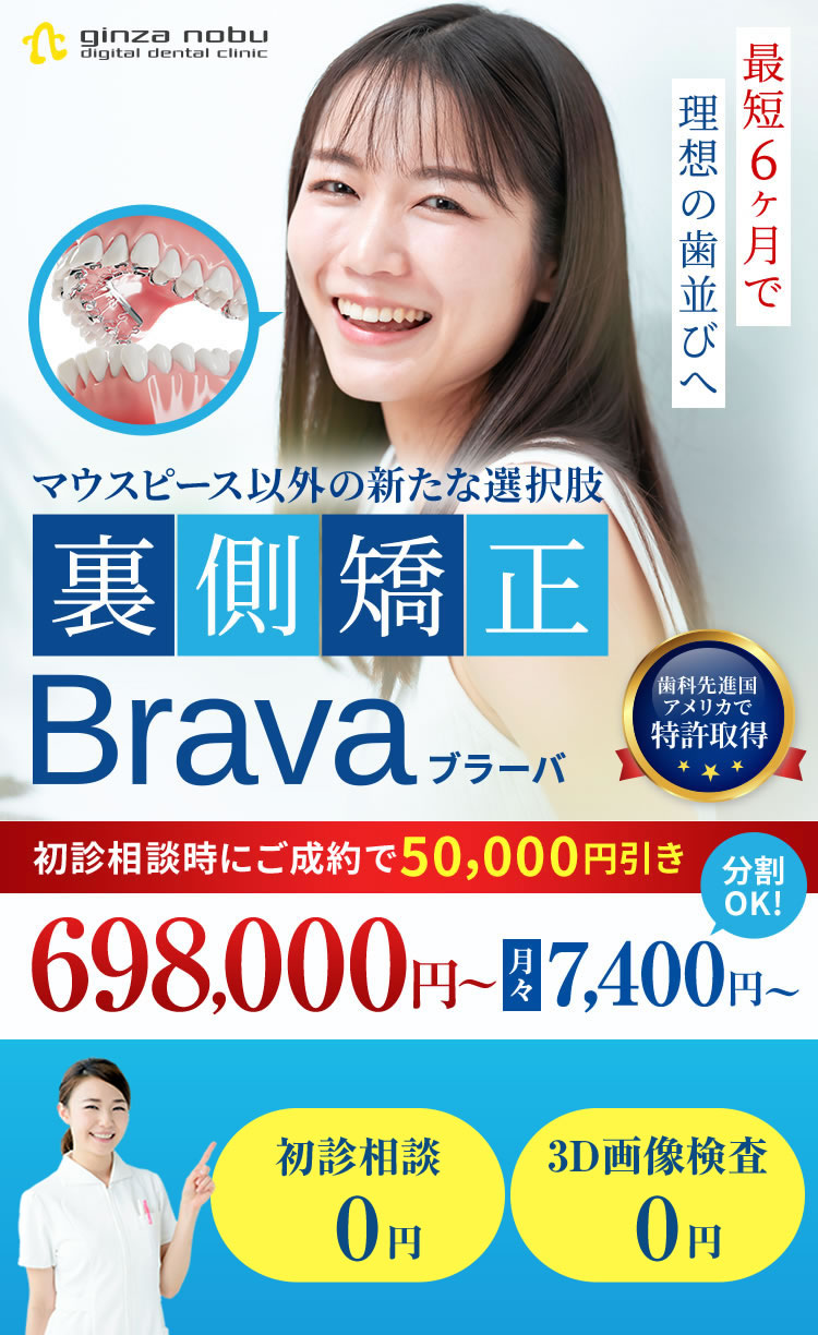 激安裏側矯正モニター募集