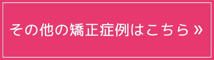 その他の矯正症例はこちら