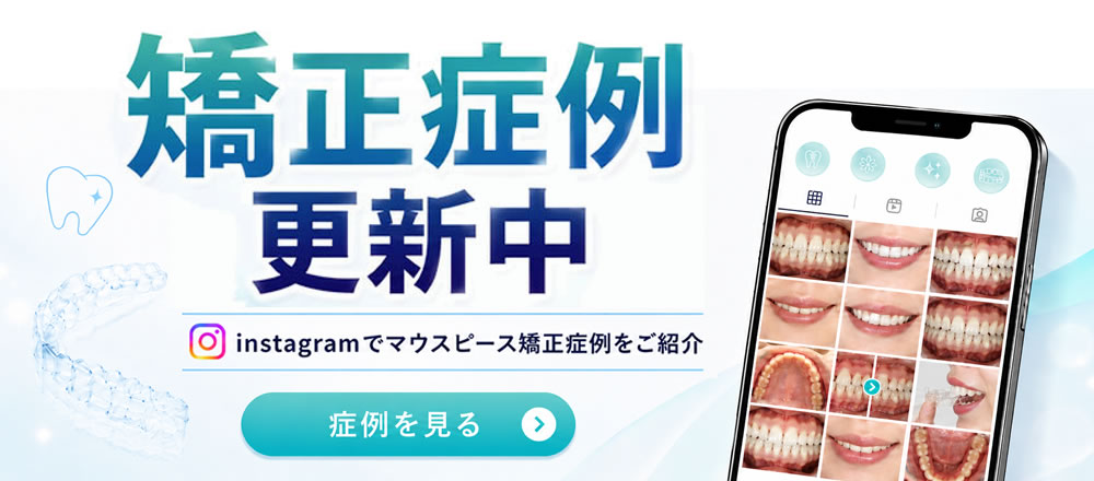 マウスピース症例はこちら