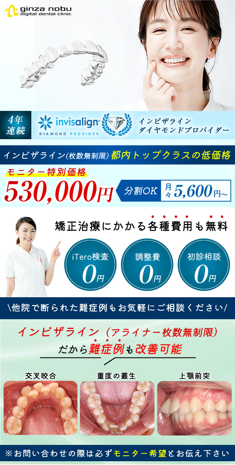 激安インビザラインモニター募集