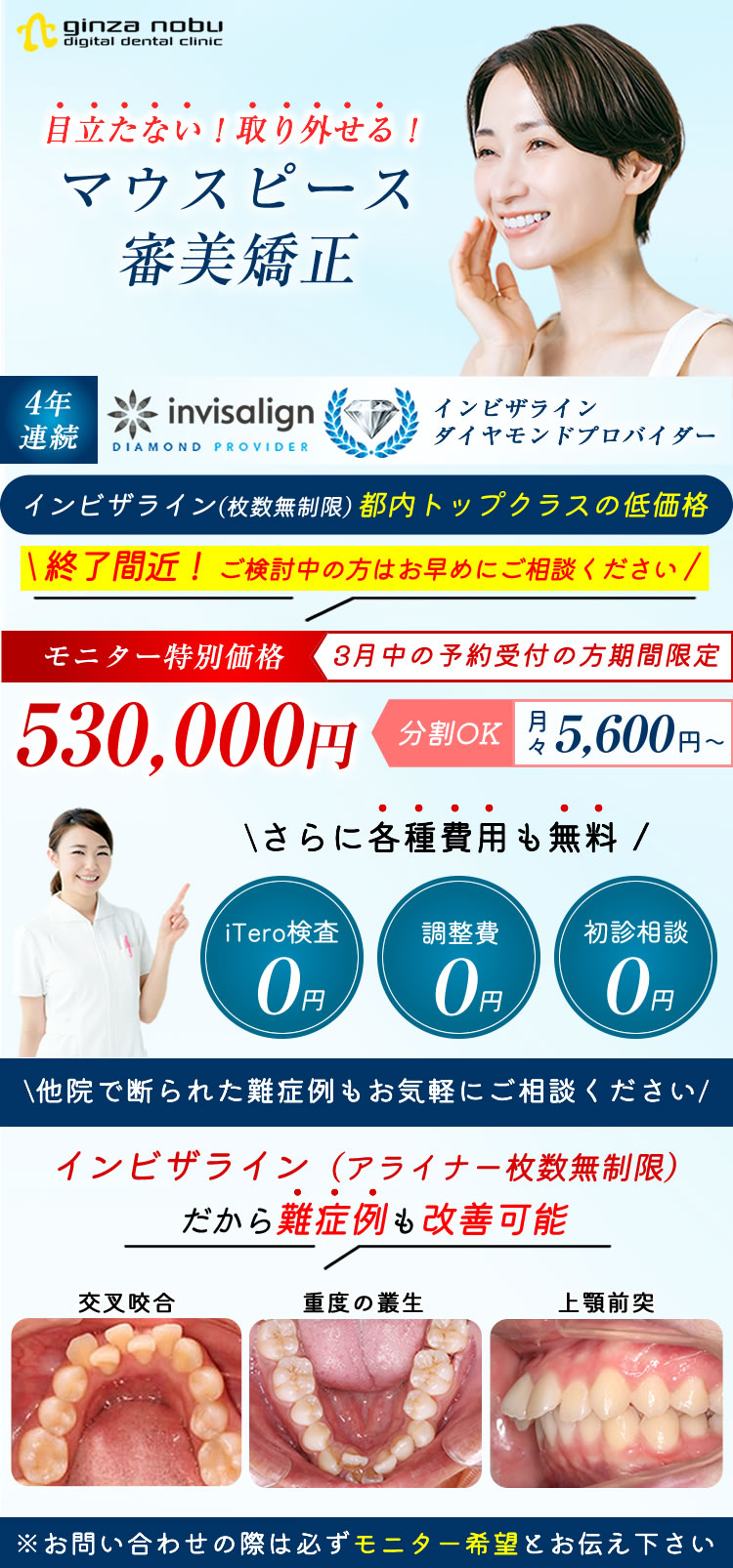 激安インビザラインモニター募集