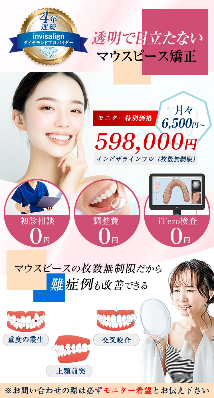 激安インビザラインモニター募集