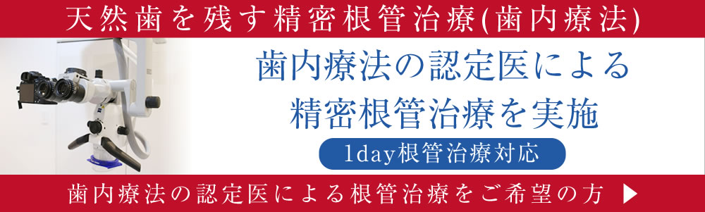 専門医・指導医による精密根管治療