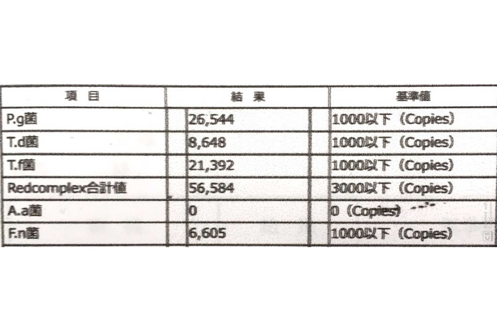 歯周病原菌のDNA検査