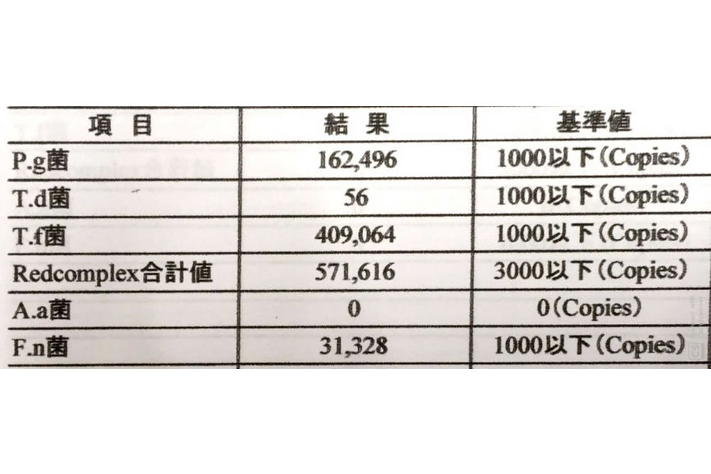 歯周病原菌のDNA検査