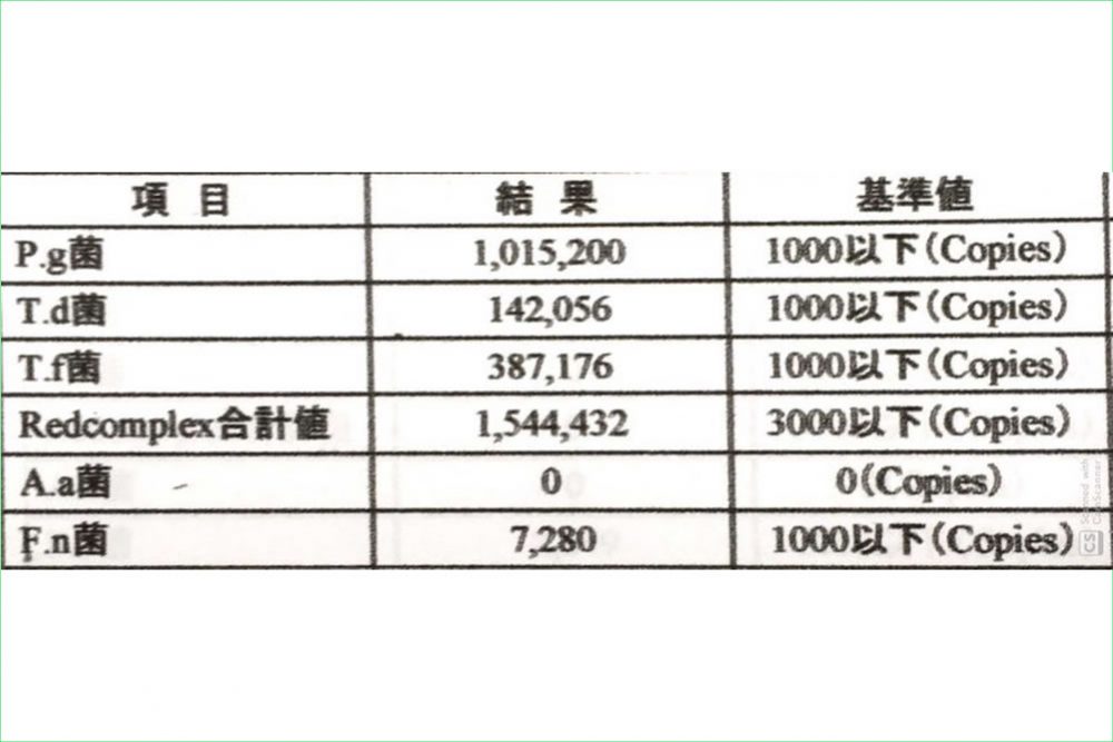 歯周病原菌のDNA検査