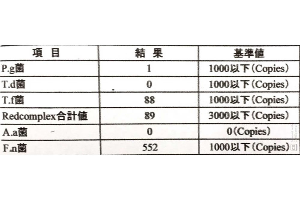 歯周病原菌のDNA検査